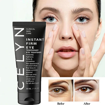 Instant Anti-Wrinkle and Eye Bag Cream by Crismaline™