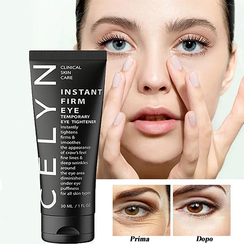 Celyn™ - La tua meraviglia di bellezza!